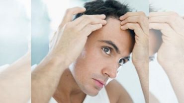 5 Foods That Stop Hair Loss